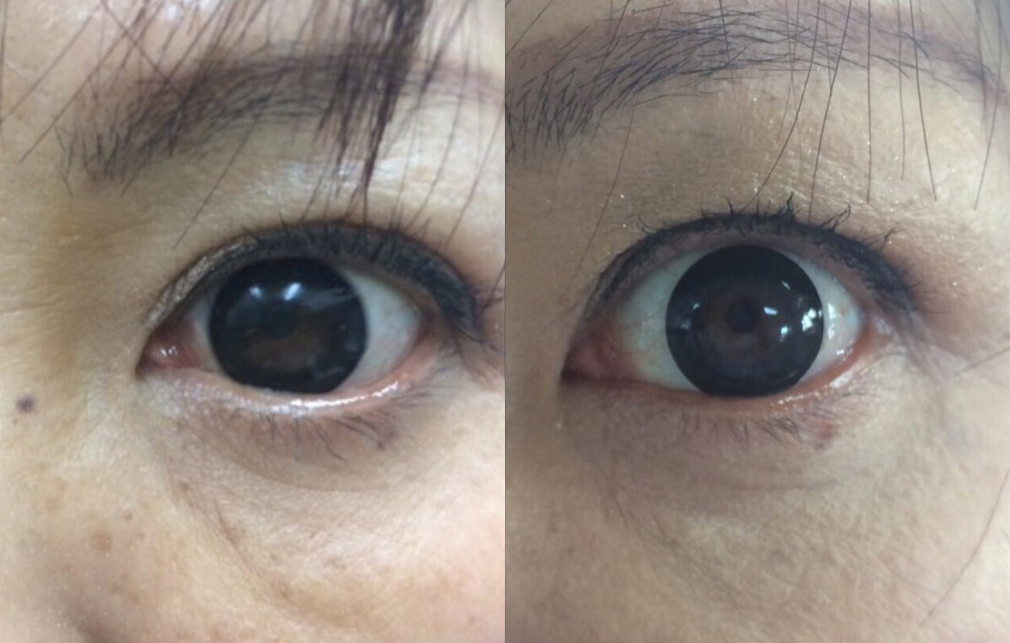 ラックレディ｜自然の力でアンチエイジングを応援する会社