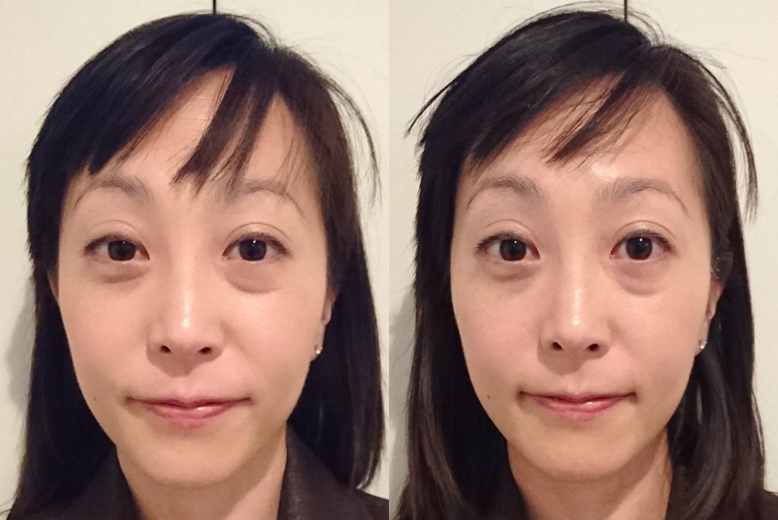 ラックレディ｜自然の力でアンチエイジングを応援する会社